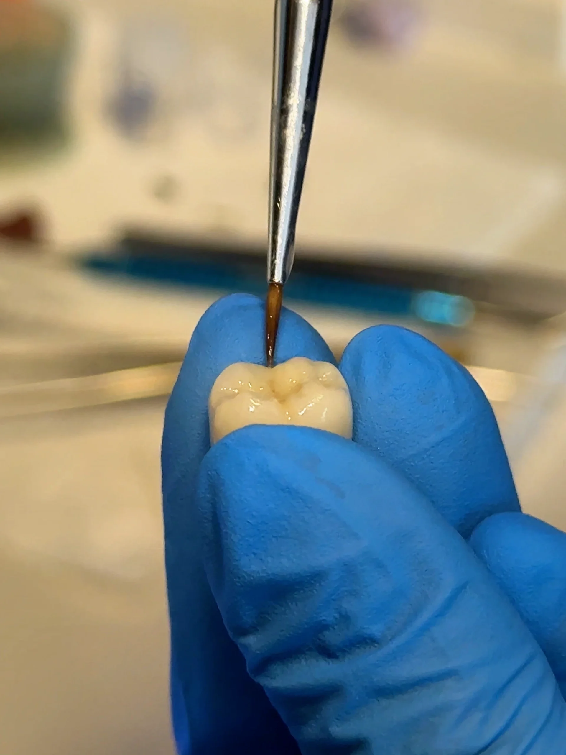 zocpbfw2uy3s197pyp4g